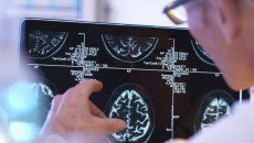 radiology images QR codes