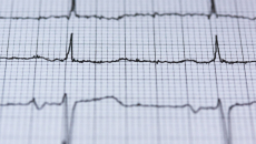 An EKG readout