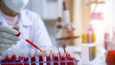 A laboratory assistant analysing blood samples