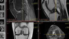 Body scans
