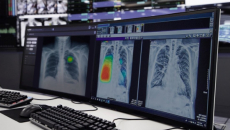 Lunit INSIGHT CXR as shown on a desktop computer