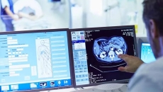 Radiologist looks at images and data on screen during a patient appointment
