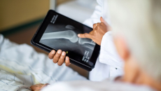 A doctor showing a bone X-ray on a digital tablet to a patient 