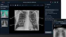 Desktop and mobile interface of a chest X-ray analysis software