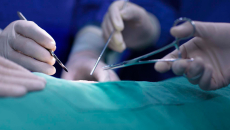 Surgeons doing surgery