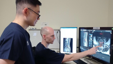 Radiologists using NUH's Spine AI