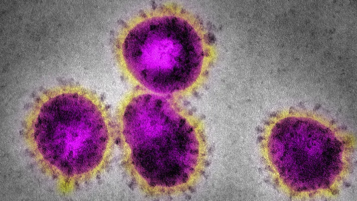 COVID-19, otherwise known as coronavirus, has entered the lexicon as if it was always there. Everyone has an opinion. Globally the response has divided and united populations and no less so in the UK, says global digital adviser and NHS clinician Dr Sam Shah.