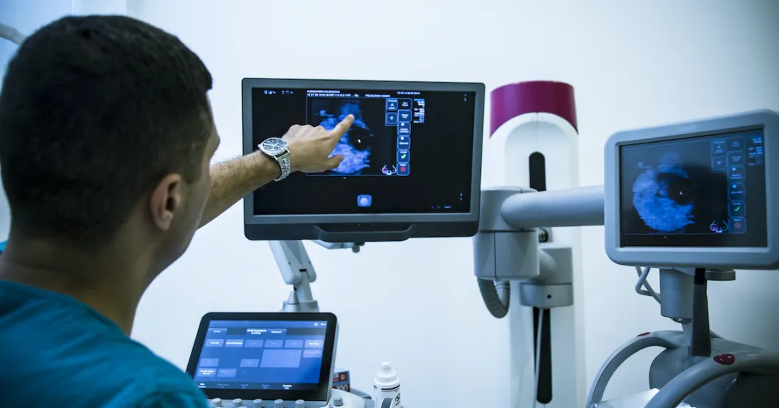 Clinician pointing at a mammography on a screen