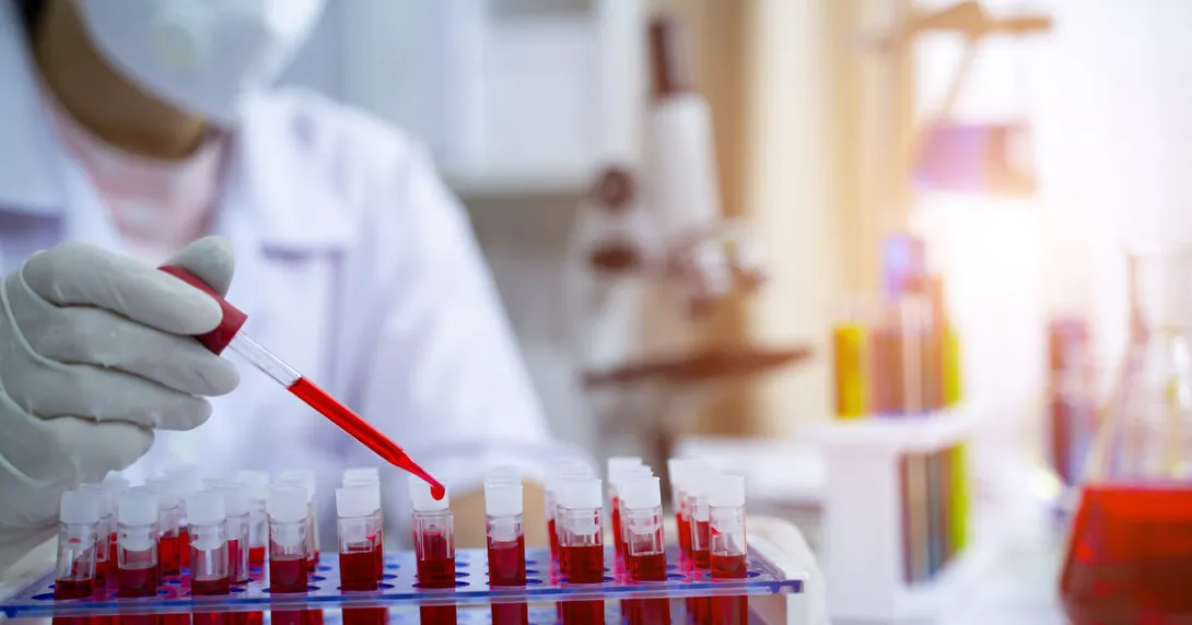A laboratory assistant analysing blood samples