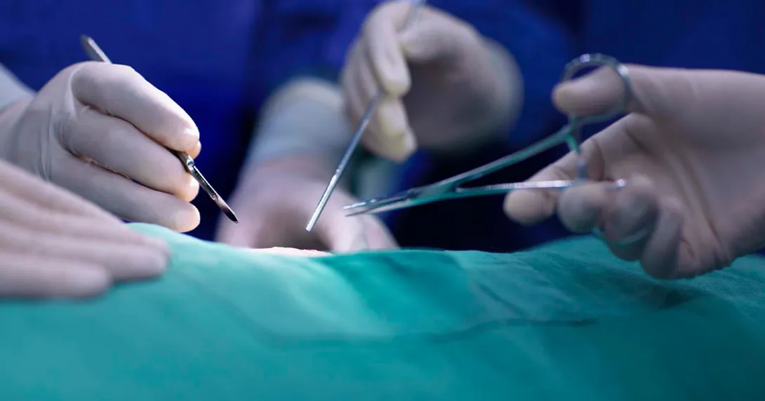 Surgeons doing surgery