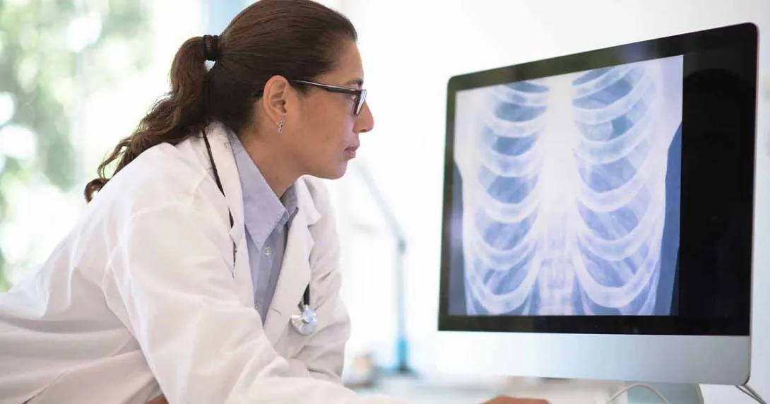 Doctor looking at an X-ray on a computer screen