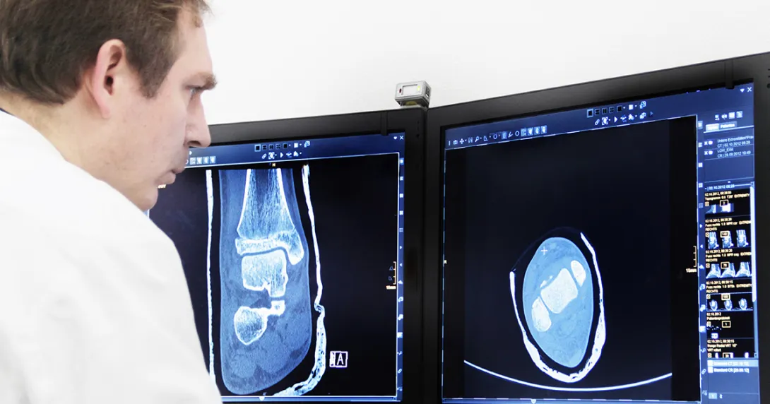 Radiologist examines X-ray
