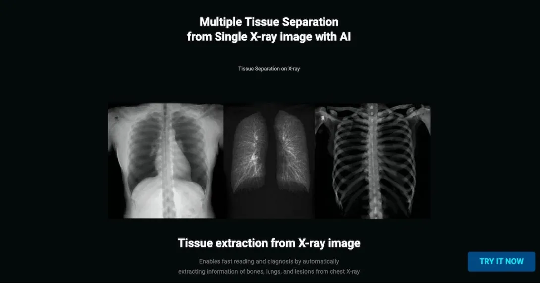 TiSepX x-ray quantitative analysis and tissue separation solution by Medical IP