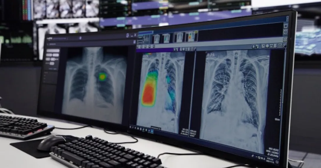 An AI software analysis of a chest X-ray