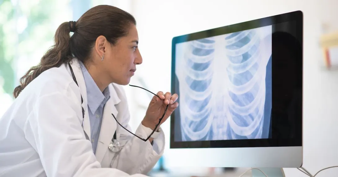 Doctor holding eyeglasses reviews chest imaging on a computer monitor.
